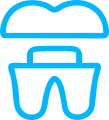 Implants Restorations