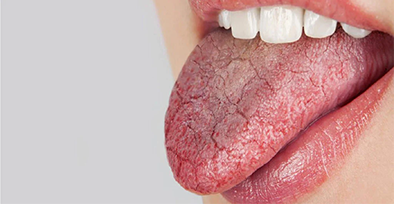Special Dental Needs Cancer Patients