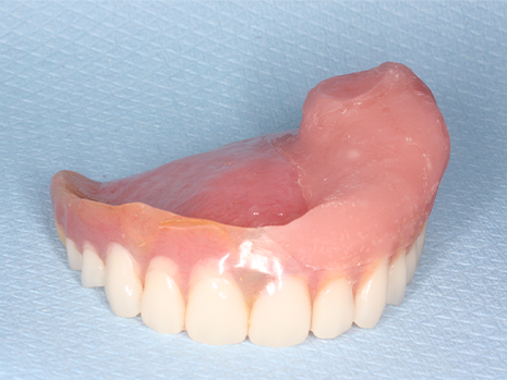 Special Dental Needs Cancer Patients